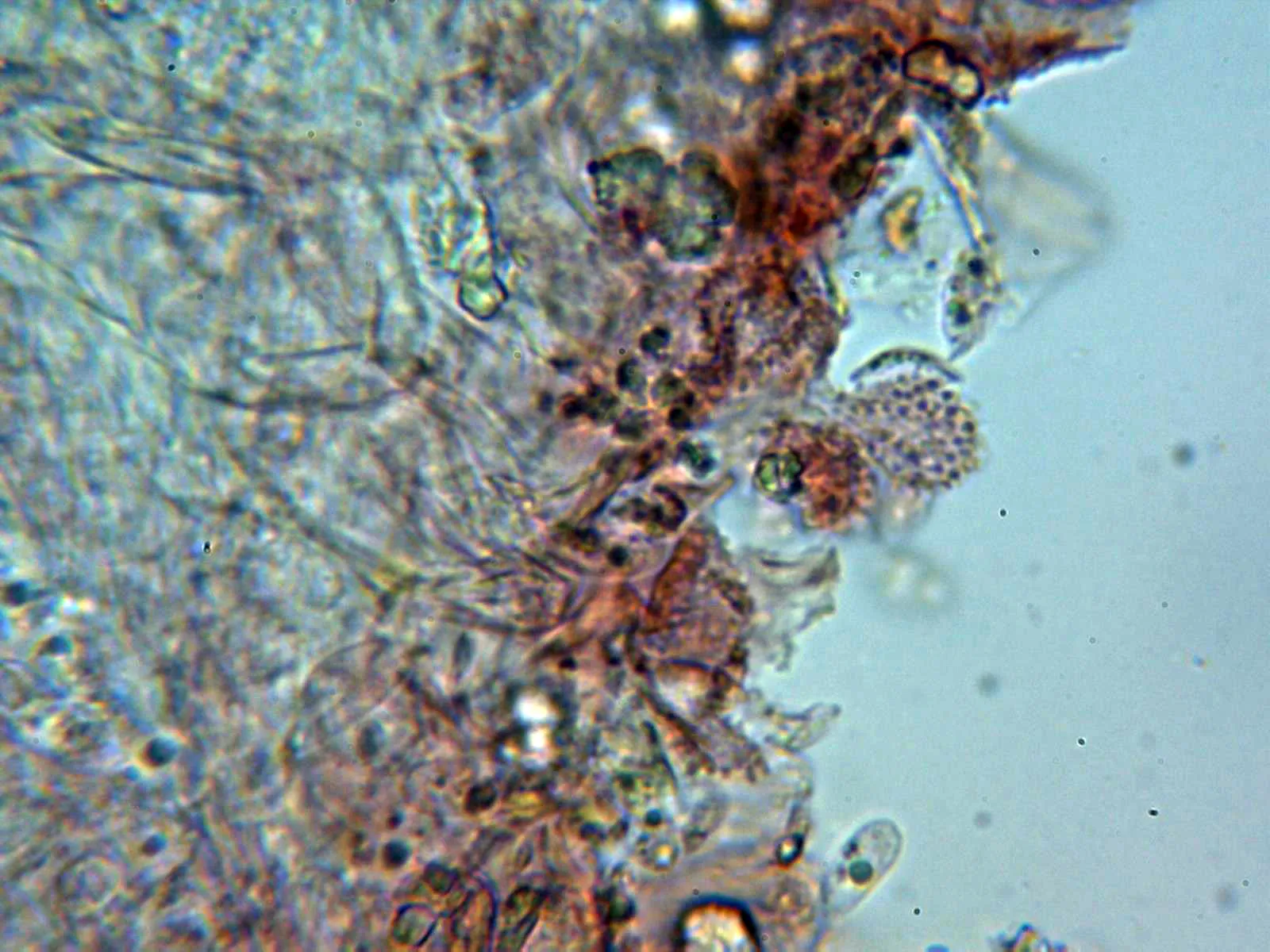 Microscopía de Mycena smithiana - 10 - Cistidios 2